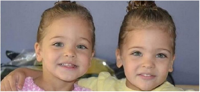All'età di sette anni, queste ragazze erano considerate le gemelle più belle del mondo